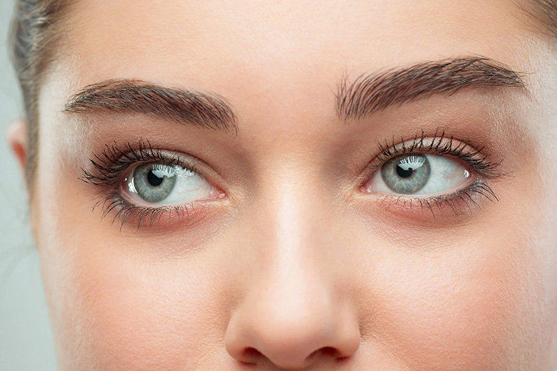 Zatezanje kapaka i uklanjanje podočnjaka - SmoothEye