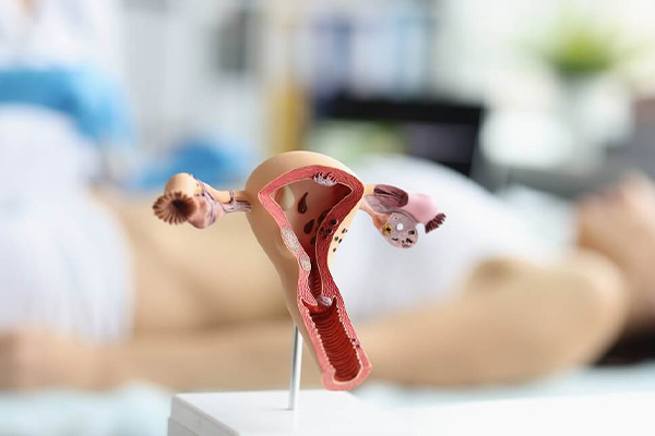 Biopsija i kiretaža grlića materice