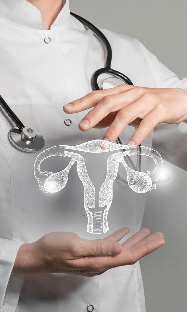 Laser u ginekologiji